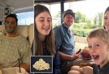 Photo of Infección dental termina en una cirugía de 7 horas