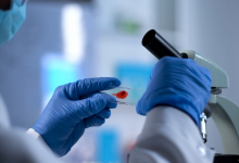 Photo of ¿ Se buscará otra opción ante fracaso de vacuna del VIH?