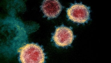 Photo of Descartan que el coronavirus sobreviva en las superficies