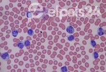 Photo of China: se escapó bacteria de laboratorio y hay 3 mil enfermos